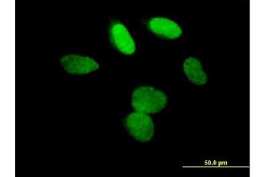 Immunofluorescence of purified MaxPab antibody to L3MBTL on HeLa cell. (L3MBTL1 anticorps  (AA 1-772))