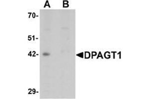 Western blot analysis of DPAGT1 in mouse kidney tissue lysate with DPAGT1 antibody at 1 μg/mL in (A) the absence and (B) the presence of blocking peptide. (DPAGT1 anticorps  (N-Term))