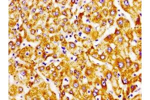 Immunohistochemistry of paraffin-embedded human liver tissue using ABIN7151799 at dilution of 1:100