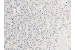 ABIN6267223 at 1/100 staining human lymphoid tissue sections by IHC-P.