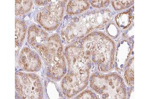 ABIN6266902 at 1/100 staining human kidney tissue sections by IHC-P. (DGKH anticorps  (Internal Region))