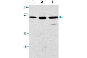 Western blot analysis of human (1), mouse (2), and rat (3) kidney cells with TICAM2 polyclonal antibody  at 1 ug/mL dilution.