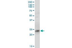 RRAS2 monoclonal antibody (M01), clone 2D3-4B8.