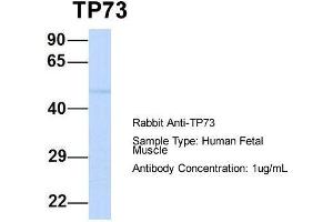Host:  Rabbit  Target Name:  TP73  Sample Type:  Human Fetal Muscle  Antibody Dilution:  1.
