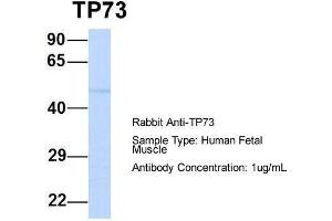 Host:  Rabbit  Target Name:  TP73  Sample Type:  Human Fetal Muscle  Antibody Dilution:  1. (Tumor Protein p73 anticorps  (N-Term))