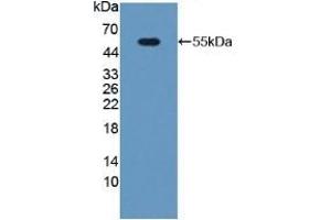 Detection of Recombinant PGP, Mouse using Polyclonal Antibody to Phosphoglycolate Phosphatase (PGP) (PGP anticorps  (AA 81-321))