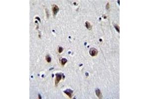 Formalin fixed, paraffin embedded human brain tissue stained with MeCP2 Antibody (N-term) followed by peroxidase conjugation of the secondary antibody and DAB staining. (MECP2 anticorps  (N-Term))