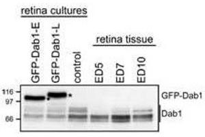WB - Dab1 Antibody Analysis of GFP-Dab1 and endogenous Dab1 levels in transfected retinal cells and retinal tissue. (DAB1 anticorps  (C-Term))