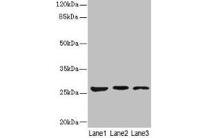 Western blot All lanes: KLK6 antibody at 5 μg/mL Lane 1: Mouse liver tissue Lane 2: Mouse brain tissue Lane 3: A375 whole cell lysate Secondary Goat polyclonal to rabbit IgG at 1/10000 dilution Predicted band size: 27, 16, 5 kDa Observed band size: 27 kDa (Kallikrein 6 anticorps  (AA 22-244))