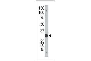 The anti-Apobec1 N-term Pab (ABIN388144 and ABIN2846479) is used in Western blot to detect Apobec in mouse small intestine tissue lysate.