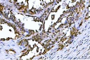 IHC analysis of TIF1 gamma using anti-TIF1 gamma antibody (ABIN3043492).