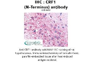 Image no. 2 for anti-Corticotropin Releasing Hormone Receptor 1 (CRHR1) (Extracellular Domain), (N-Term) antibody (ABIN1733304) (CRHR1 anticorps  (Extracellular Domain, N-Term))