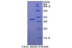 SDS-PAGE analysis of Human CNTFR Protein.