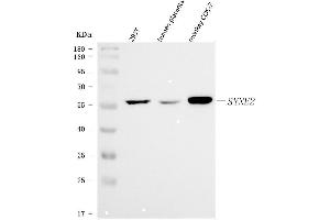 Western blot analysis of Nesprin 2/SYNE2 using anti-Nesprin 2/SYNE2 antibody (ABIN7601532).