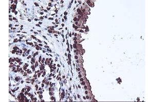 Immunohistochemical staining of paraffin-embedded Human breast tissue using anti-OSGEP mouse monoclonal antibody. (OSGEP anticorps  (AA 1-335))