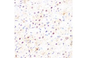 Immunohistochemistry of paraffin-embedded rat ovary using DP1/TFDP1 Rabbit mAb (ABIN7270891) at dilution of 1:100 (40x lens).