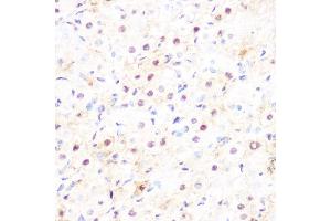 Immunohistochemistry of paraffin-embedded rat ovary using DP1/TFDP1 Rabbit mAb (ABIN7270891) at dilution of 1:100 (40x lens). (DP1 anticorps)