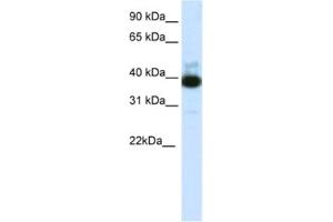 Western Blotting (WB) image for anti-Tetratricopeptide Repeat Domain 19 (TTC19) antibody (ABIN2462033) (TTC19 anticorps)