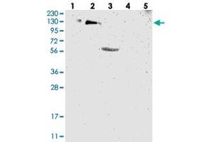 Western blot analysis of Lane 1: RT-4, Lane 2: U-251 MG, Lane 3: Human Plasma, Lane 4: Liver, Lane 5: Tonsil with USP36 polyclonal antibody  at 1:250-1:500 dilution. (USP36 anticorps)