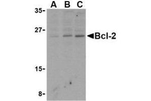 Western blot analysis of Bcl-2 in Daudi cell lysates with AP30128PU-N Bcl-2 antibody at (A) 1, (B) 2, and (C) 4 μg/ml. (Bcl-2 anticorps  (N-Term))