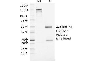 SDS-PAGE Analysis Purified NSE gamma Mouse Monoclonal Antibody (ENO2/1462). (ENO2/NSE anticorps  (AA 416-433))