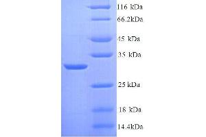 Kininogen 1 (KNG1) (AA 390-639), (full length) protein (His tag)