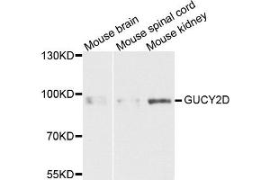 Western blot analysis of extracts of various cells, using GUCY2D antibody. (GUCY2D anticorps)