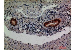 Immunohistochemical analysis of paraffin-embedded human-liver, antibody was diluted at 1:200