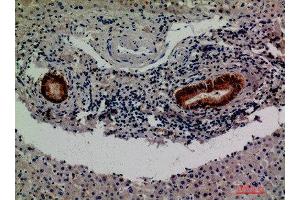 Immunohistochemical analysis of paraffin-embedded human-liver, antibody was diluted at 1:200 (F13B anticorps  (Internal Region))