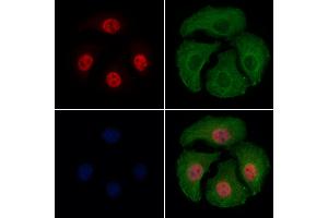 ABIN6256594 and ABIN6267389 staining Hela cells(4h of LPS treatment) by IF/ICC. (ATF2 anticorps  (pThr51, pThr69))