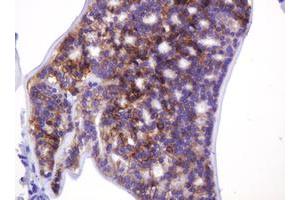 Image no. 4 for anti-Carbonic Anhydrase 12 (CA12) antibody (ABIN1497068)