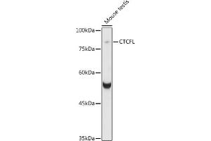 Western blot analysis of extracts of various cell lines, using CTCFL antibody (ABIN6131039, ABIN6139183, ABIN6139185 and ABIN6221755) at 1:1000 dilution. (CTCFL anticorps  (AA 1-270))
