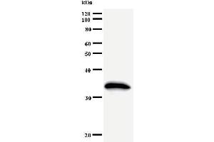 Western Blotting (WB) image for anti-General Transcription Factor IIH, Polypeptide 2, 44kDa (GTF2H2) antibody (ABIN930961) (GTF2H2 anticorps)
