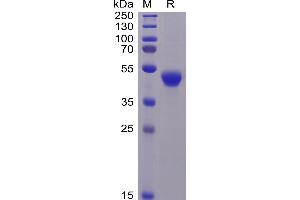 Human CD5 Protein, His Tag on SDS-PAGE under reducing condition.