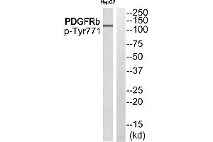 Western blot analysis of extracts from HepG2 cells, using EPS15 (Phospho-Tyr849) antibody.