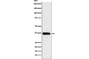 Western blot analysis of HSD11B1 expression in human fetal liver lysate.