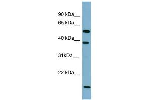 WB Suggested Anti-SLC10A1 Antibody Titration:  0. (SLC10A1 anticorps  (Middle Region))
