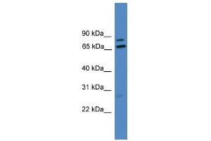 WB Suggested Anti-LRRFIP1 Antibody Titration: 0. (LRRFIP1 anticorps  (Middle Region))