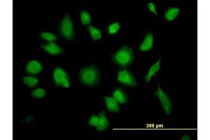 Immunofluorescence of purified MaxPab antibody to TTC1 on HeLa cell. (TTC1 anticorps  (AA 1-292))