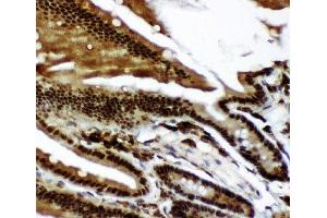 IHC-P: p73 antibody testing of mouse intestine tissue