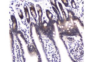 IHC analysis of DGCR8 using anti-DGCR8 antibody (ABIN5692841). (DGCR8 anticorps  (AA 561-762))