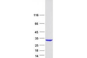 Validation with Western Blot