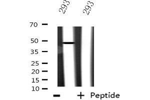 Western blot analysis of extracts from 293 cells using CSTF1 antibody. (CSTF1 anticorps  (N-Term))