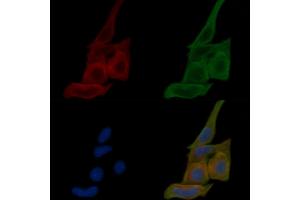ABIN6259118 and ABIN6274339 staining Hela cells(24h of starvation treatment) by IF/ICC.