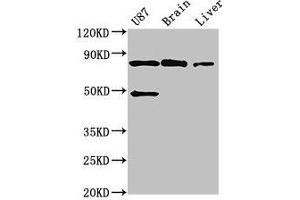 Western Blot Positive WB detected in: U87 whole cell lysate, Mouse brain tissue, Mouse liver tissue All lanes: GARS antibody at 3 μg/mL Secondary Goat polyclonal to rabbit IgG at 1/50000 dilution Predicted band size: 84 kDa Observed band size: 84 kDa