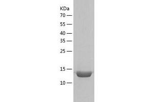 Western Blotting (WB) image for Cellular Retinoic Acid Binding Protein 2 (CRABP2) (AA 2-138) protein (His-IF2DI Tag) (ABIN7122237)