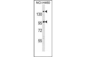 Western blot analysis of SSC5D Antibody  in NCI-H460 cell line lysates (35ug/lane). (SSC5D anticorps  (Middle Region))