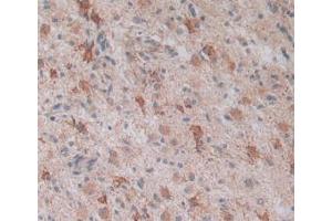 Figure. (LPCAT3 anticorps  (AA 122-233))