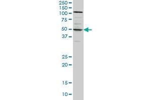 SYT4 monoclonal antibody (M04A), clone 5F8 Western Blot analysis of SYT4 expression in A-431 . (SYT4 anticorps  (AA 1-99))