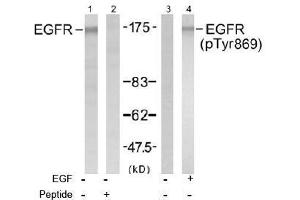 Image no. 1 for anti-Epidermal Growth Factor Receptor (EGFR) (Tyr869) antibody (ABIN197464)